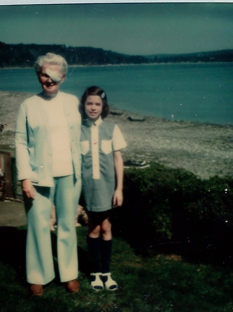 Adult woman with white hair and a bandage over her eye standing next to a young girl in front of a beach